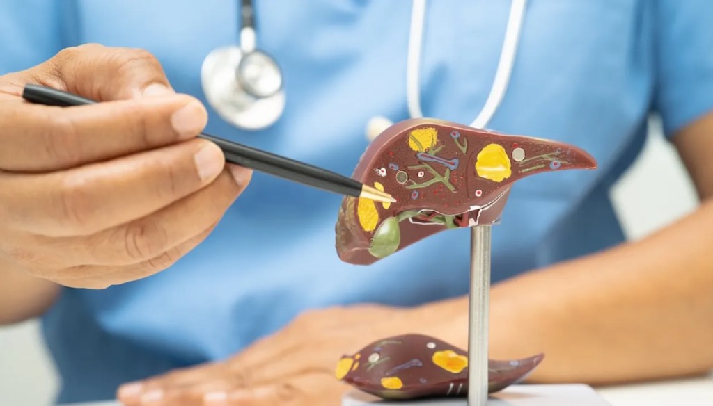 Breakthrough Blood Test Can Predict Severe Liver Disease Years Before Symptoms&nbsp;Start